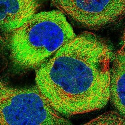 IFT122 Antibody, Novus Biologicals 25 &mu;L; Unlabeled:Antibodies, Polyclonal