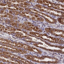 IFT122 Antibody, Novus Biologicals 25 &mu;L; Unlabeled:Antibodies, Polyclonal