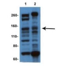 IFT140 Antibody, Novus Biologicals 100 &mu;L | Buy Online | Novus Biologicals | Fisher Scientific