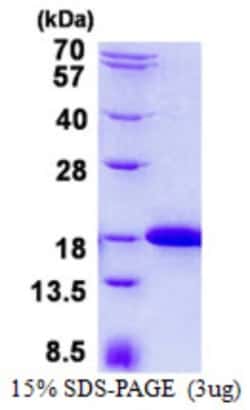 Novus Biologicals&trade;&nbsp;Recombinant Human IFT20 His Protein