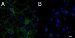 IFT74 Antibody, Novus Biologicals 0.1mg; Unlabeled:Antibodies, Polyclonal