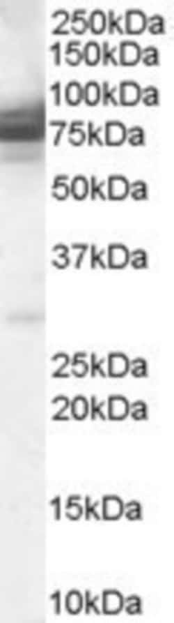IFT74 Antibody, Novus Biologicals 0.1mg; Unlabeled:Antibodies, Polyclonal
