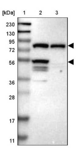 IFT81 Antibody, Novus Biologicals:Antibodies:Primary Antibodies