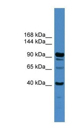 IFT88 Antibody, Novus Biologicals 100&mu;L; Unlabeled:Antibodies, Polyclonal