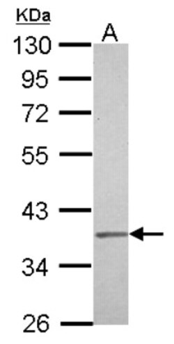 IGBP1 Antibody, Novus Biologicals 0.1mL; Unlabeled:Antibodies, Polyclonal