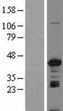 Novus Biologicals&trade;&nbsp;IGBP1 Overexpression Lysate