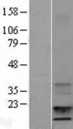 Novus Biologicals&trade;&nbsp;IGF-I/IGF-1 Overexpression Lysate