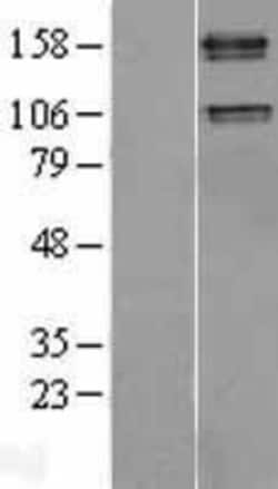 Novus Biologicals&trade;&nbsp;IGF-I R/IGF1R Overexpression Lysate
