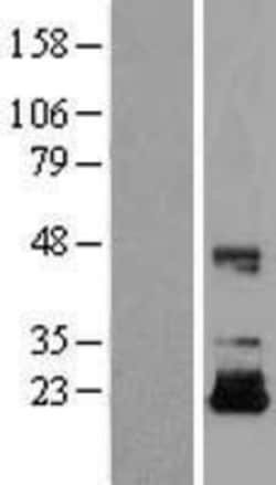 Novus Biologicals&trade;&nbsp;IGF-II/IGF2 Overexpression Lysate