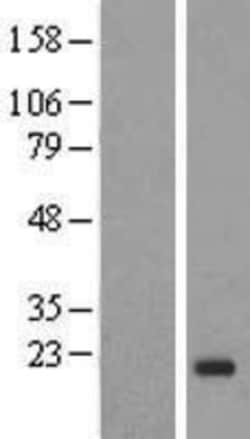 Novus Biologicals&trade;&nbsp;IGF-II/IGF2 Overexpression Lysate