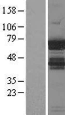 Novus Biologicals&trade;&nbsp;IGF2BP1 Overexpression Lysate