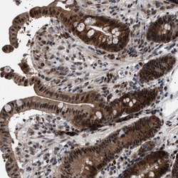 IGF2BP1 Antibody, Novus Biologicals 0.1mL; Unlabeled:Antibodies, Polyclonal