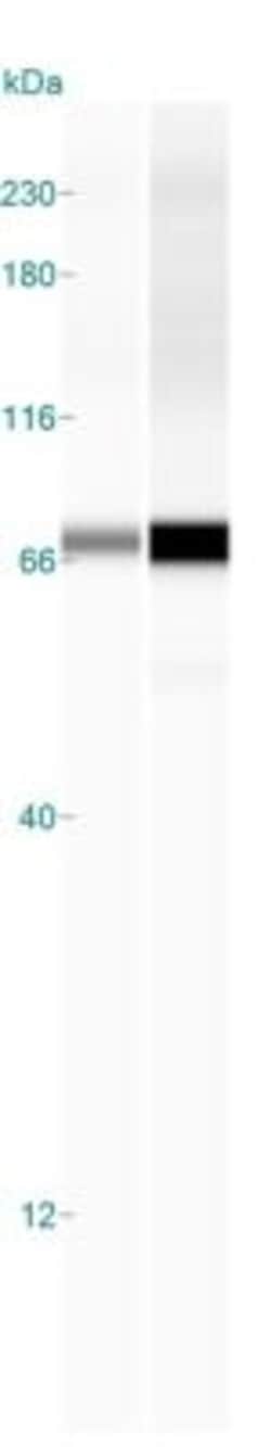 IGF2BP1 Antibody, Novus Biologicals:Antibodies:Primary Antibodies