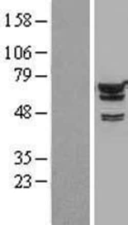 Novus Biologicals&trade;&nbsp;IMP2/IGF2BP2 Overexpression Lysate