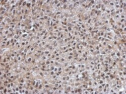 IGF2BP3 Antibody, Novus Biologicals 0.1mL; Unlabeled:Antibodies, Polyclonal