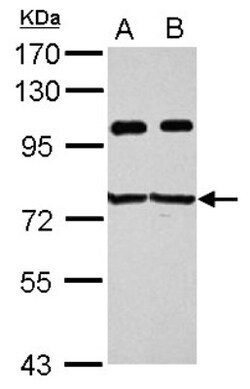 IGF2BP3 Antibody, Novus Biologicals 0.1mL; Unlabeled:Antibodies, Polyclonal