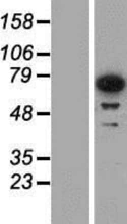 Novus Biologicals&trade;&nbsp;IGF2BP3 Overexpression Lysate