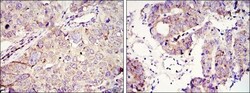 IGF2BP3 Antibody (8F11), Novus Biologicals 0.1mL; Unlabeled:Antibodies,