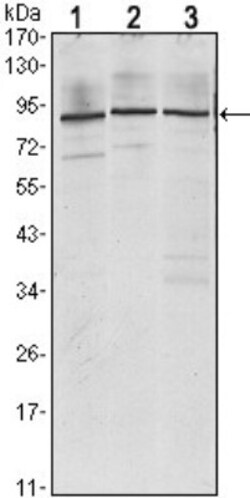 IGF2BP3 Antibody (8F11), Novus Biologicals 0.1mL; Unlabeled:Antibodies,
