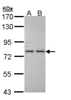 IGFALS/ALS Antibody, Novus Biologicals 0.1mL; Unlabeled:Antibodies, Polyclonal