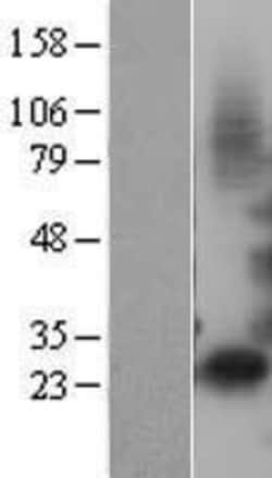 Novus Biologicals&trade;&nbsp;IGFBP-1 Overexpression Lysate