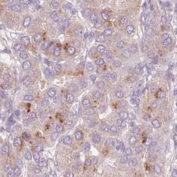 IGFBP-1 Antibody, Novus Biologicals:Antibodies:Primary Antibodies