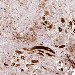 IGFBP-1 Antibody, Novus Biologicals:Antibodies:Primary Antibodies