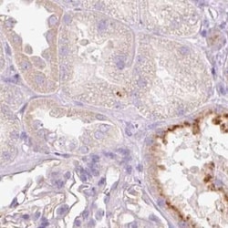 IGFBP-1 Antibody, Novus Biologicals:Antibodies:Primary Antibodies