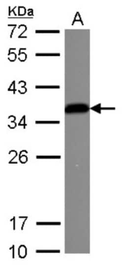 IGFBP-3 Antibody, Novus Biologicals 0.1mL; Unlabeled:Antibodies, Polyclonal