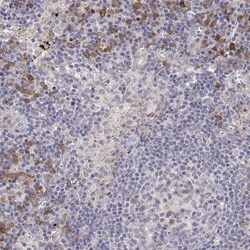 IGFBP-4 Antibody, Novus Biologicals 25 &mu;L, Unlabeled:Antibodies, Polyclonal