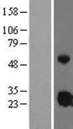 Novus Biologicals&trade;&nbsp;IGFBP-4 Overexpression Lysate