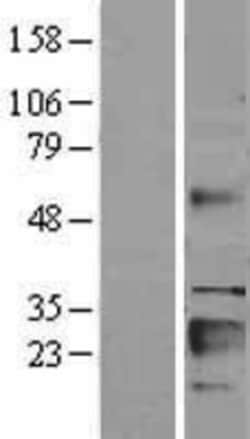 Novus Biologicals&trade;&nbsp;IGFBP-6 Overexpression Lysate