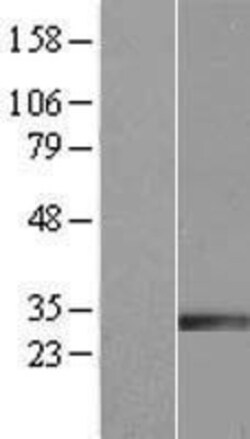 Novus Biologicals&trade;&nbsp;IGFBP-rp1/IGFBP-7 Overexpression Lysate
