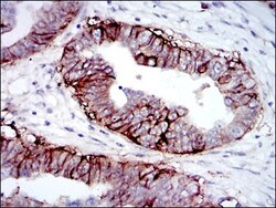 IGF-I R/IGF1R Antibody (3G5C1), Novus Biologicals:Antibodies:Primary Antibodies