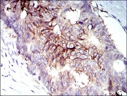 IGF-I R/IGF1R Antibody (3G5C1), Novus Biologicals:Antibodies:Primary Antibodies