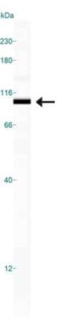 IGF-I R/IGF1R Antibody - BSA Free, Novus Biologicals 0.025mL; Unlabeled:Antibodies,