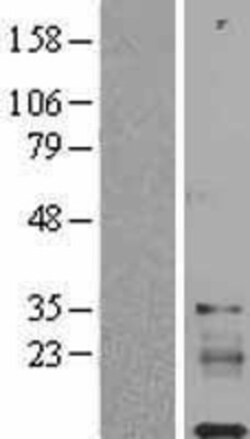 Novus Biologicals™ IGFL1 Overexpression Lysate