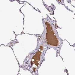 IGFL1 Antibody, Novus Biologicals 25 &mu;L, Unlabeled:Antibodies, Polyclonal