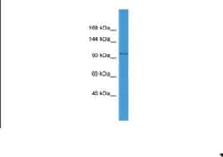 IGHMBP2 Antibody, Novus Biologicals 100&mu;L; Unlabeled:Antibodies, Polyclonal