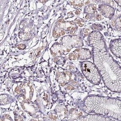 IGIP Antibody, Novus Biologicals:Antibodies:Primary Antibodies