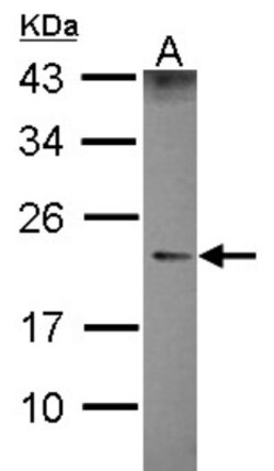 Lambda5/IGLL1 Antibody, Novus Biologicals 0.1 mL | Buy Online | Novus Biologicals | Fisher Scientific