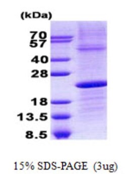 Novus Biologicals&trade;&nbsp;Recombinant Human Lambda5/IGLL1 His Protein