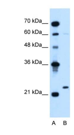 Lambda5/IGLL1 Antibody, Novus Biologicals:Antibodies:Primary Antibodies