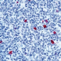 IgM Antibody:Antibodies:Primary Antibodies