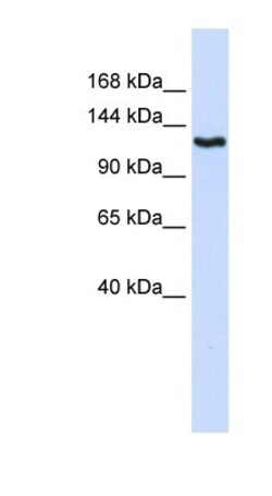 IGSF1 Antibody, Novus Biologicals 100&mu;L; Unlabeled:Antibodies, Polyclonal