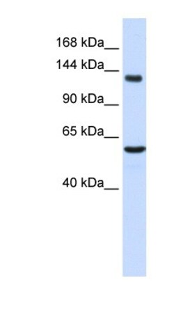 IGSF1 Antibody, Novus Biologicals 100&mu;L; Unlabeled:Antibodies, Polyclonal