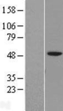 Novus Biologicals&trade;&nbsp;VSIG3/IGSF11 Overexpression Lysate