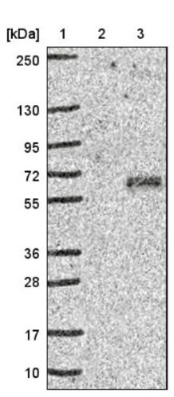 IGSF21 Antibody, Novus Biologicals 0.1 mL | Buy Online | Novus Biologicals | Fisher Scientific