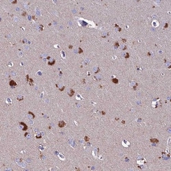 IGSF21 Antibody, Novus Biologicals 0.1 mL | Buy Online | Novus Biologicals | Fisher Scientific