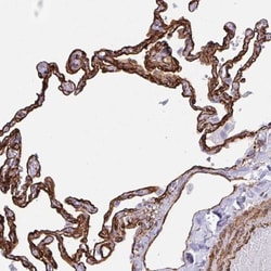 IGSF23 Antibody, Novus Biologicals:Antibodies:Primary Antibodies